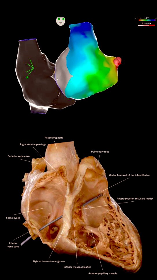 🧠🫀 Cardiac anatomy and its correlation with electrophysiology. 🫀🧠