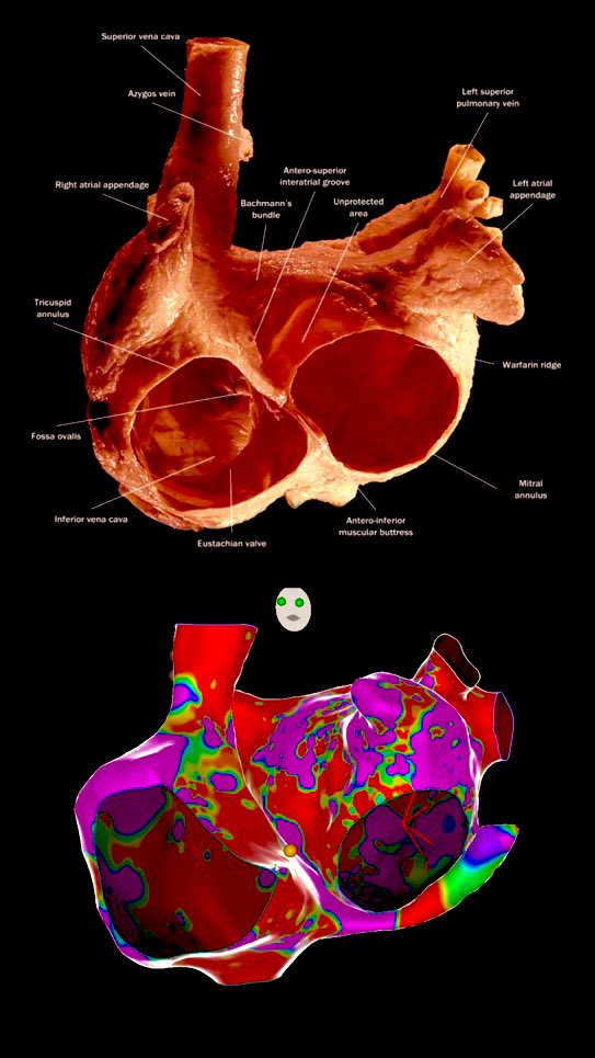 🧠🫀 Cardiac anatomy and its correlation with electrophysiology. 🫀🧠