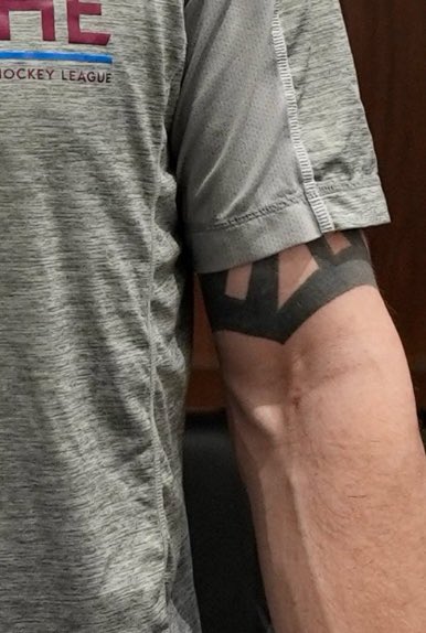 gmanuelian's tweet photo. @Avalanche Genuine question .. Could these be from IVs? https://t.co/yqbuamtH1q