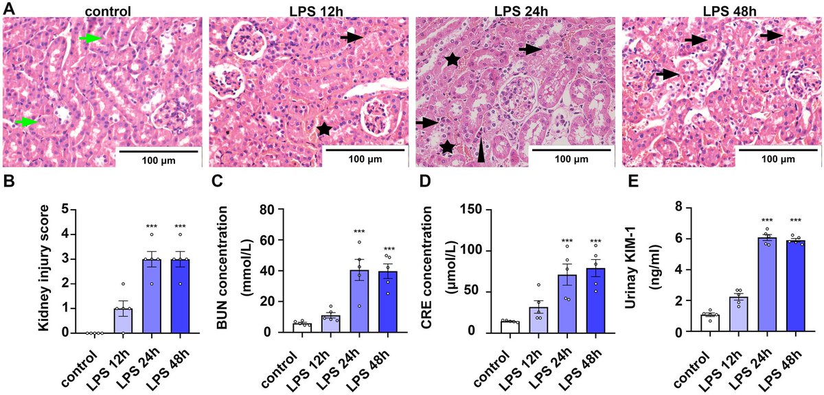 Cytosolic mtDNA–cGAS–STING axis contributes to sepsis-induced acute kidney injury via activating the NLRP3 inflamma… link.springer.com/10.1007/s10157…