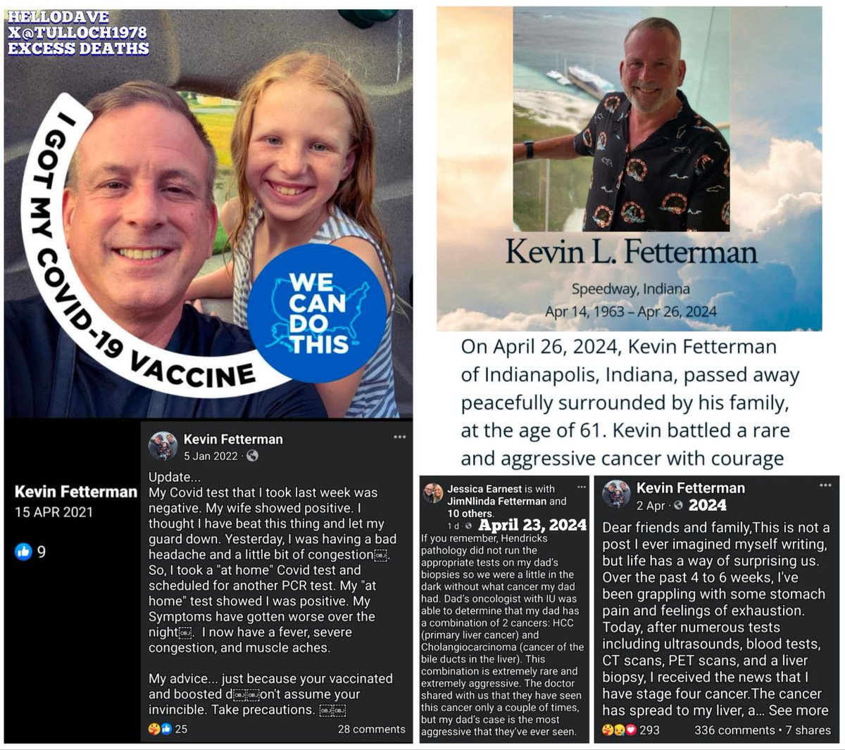 Indiana: Kevin Fetterman, died within weeks of being diagnosed with a combination of extremely rare & aggressive liver cancer. HCC & Cholangiocarcinoma.

'The doctor said it's the most aggressive case they’ve ever seen.' 

#diedsuddenly April 2024 #Pfizer

legacy.com/obituaries/nam…