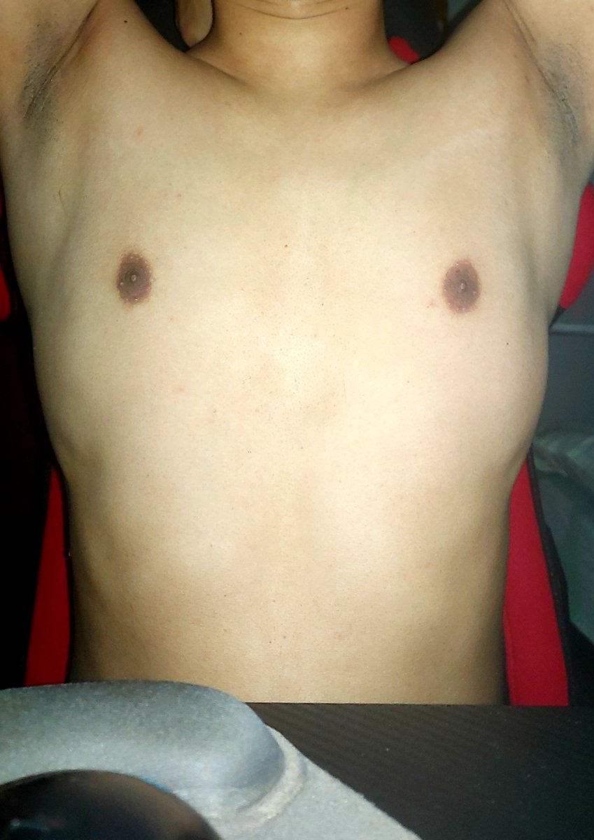 KaiserBlake69's tweet photo. Shave or no shave?

#SarapNgPinoy #Pinoy #SarapNgBagets #Bagets #AlterPhilippines #AlterPinoy #AlterPh #Alter #Pits #Armpit #Hairy #HairyArmpits https://t.co/nBqjWso788