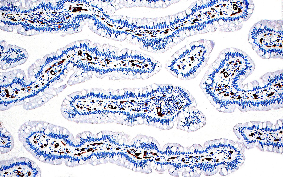 Small Bowel Villi, CD-34 immunostain ~ #PathArt #IHCpath