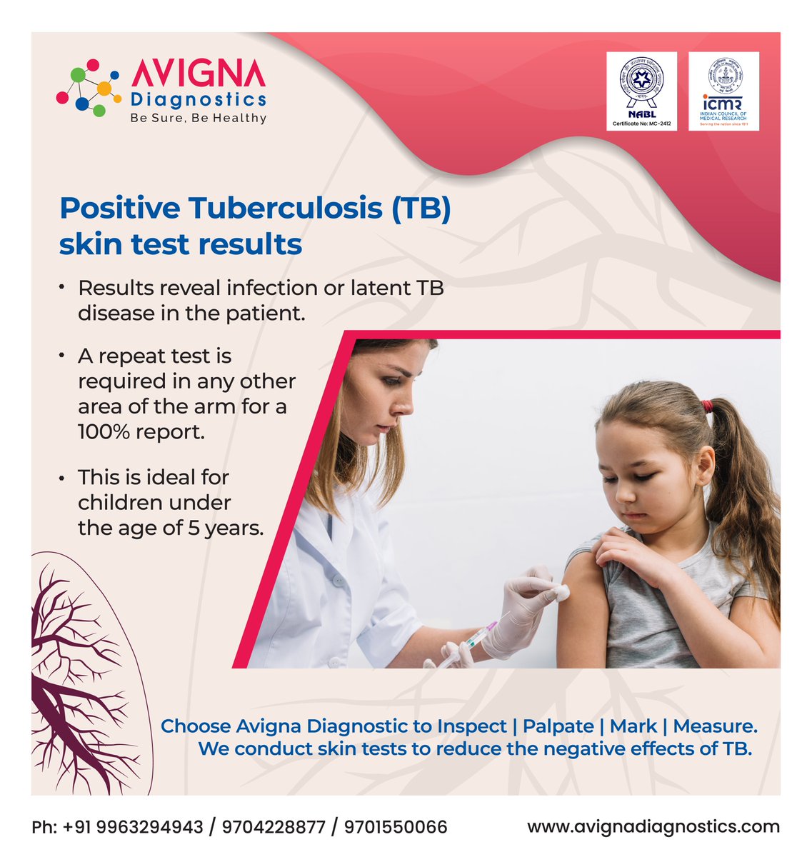 Positive Tuberculosis (TB) skin test results.
 
Choose Avigna Diagnostic to Inspect | Palpate | Mark | Measure. We conduct skin tests to reduce the negative effects of TB. 

#Tuberculosis #TB #SkinTest #SkinTests #Skin #HealthCare #AvignaDiagnostic #PregnantWomen