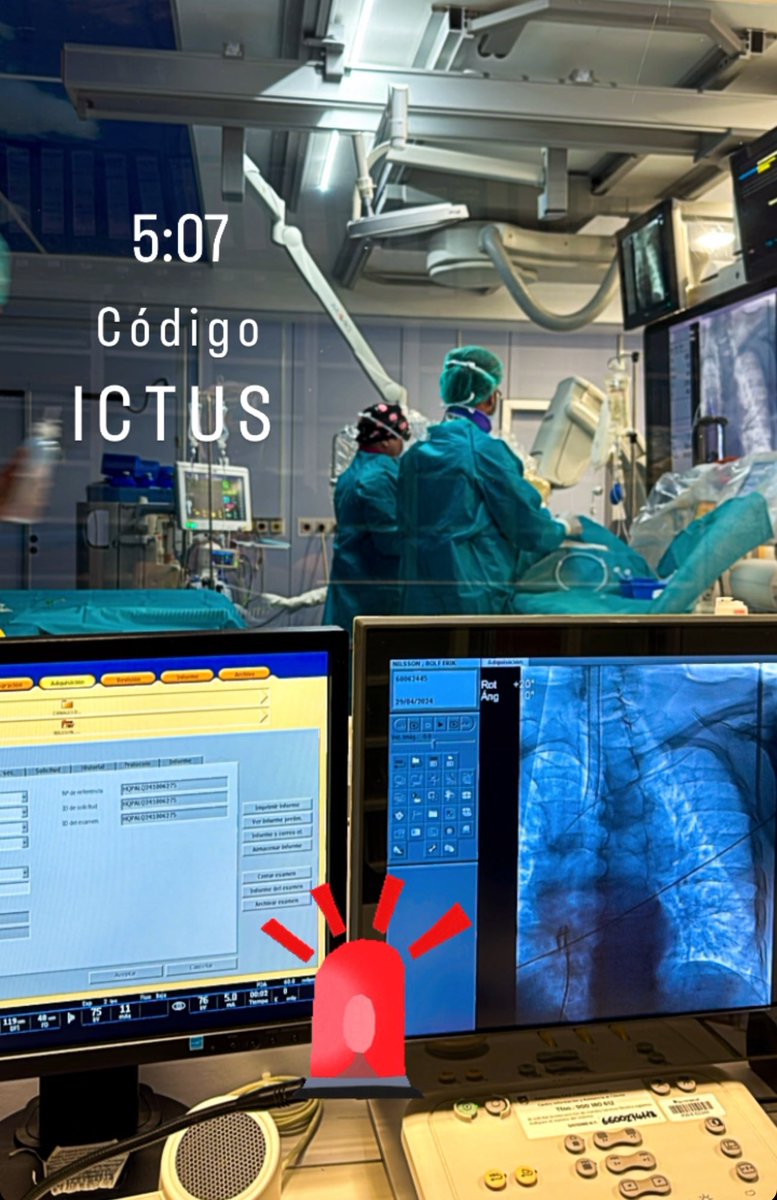 Código ICTUS 🧠 👨🏻‍⚕️ 

🥱🥱 

#ictus #Neurology