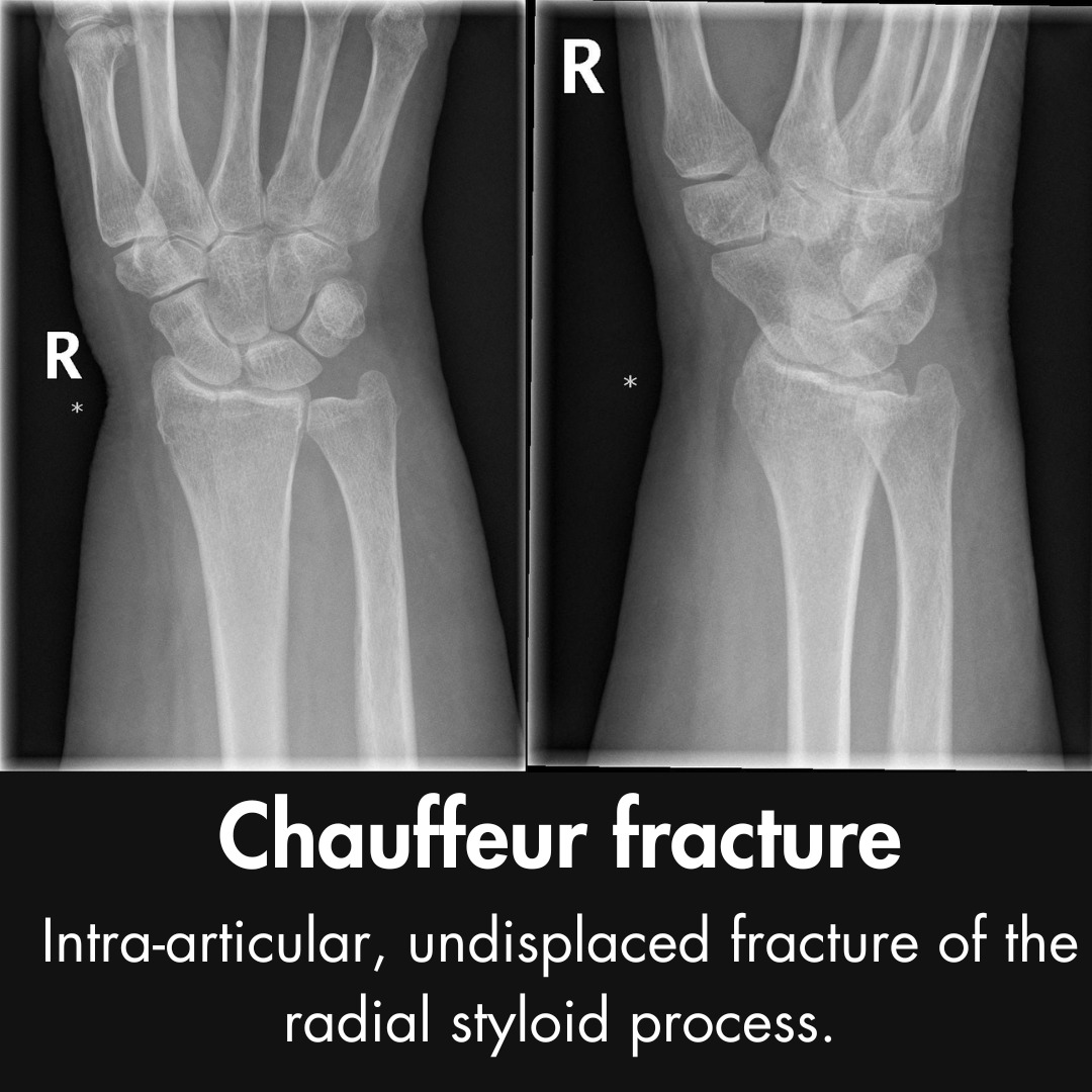 Orthopaedic Tutorials tweet media