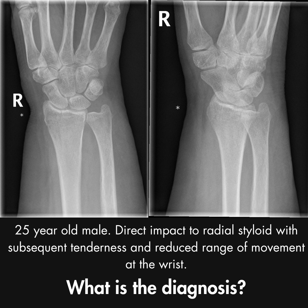Orthopaedic Tutorials tweet media
