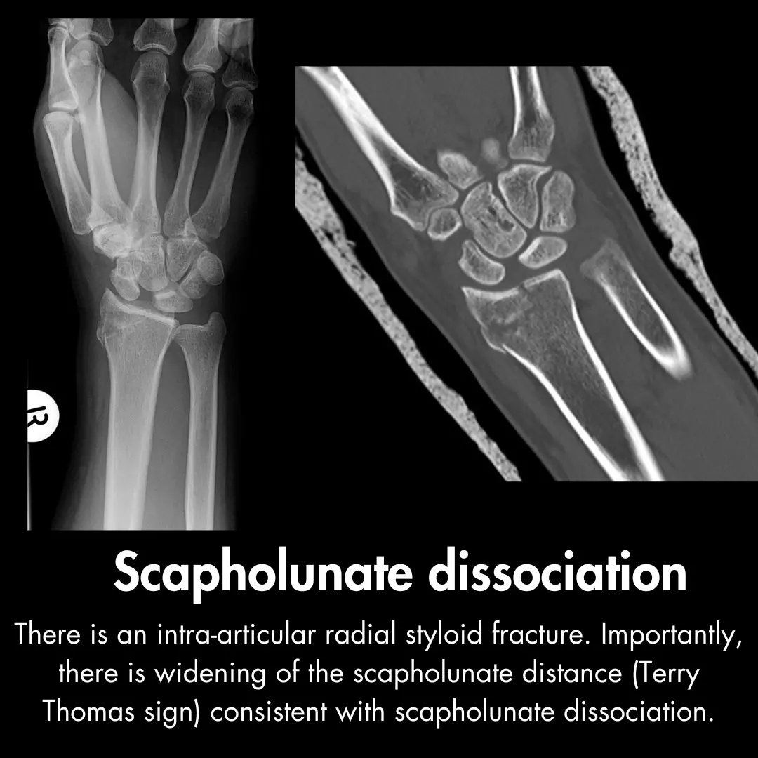 Orthopaedic Tutorials tweet media