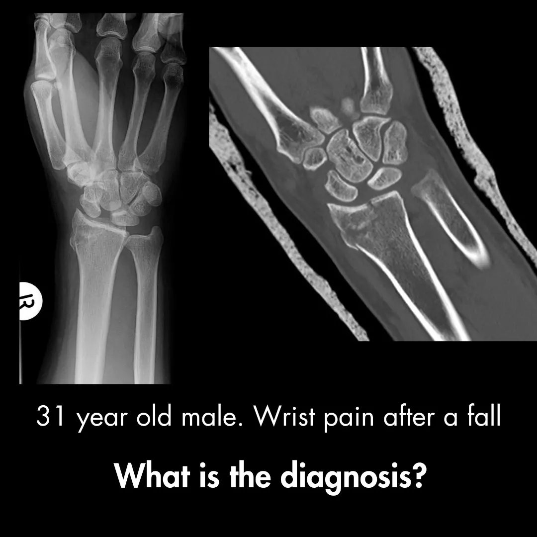 Orthopaedic Tutorials tweet media