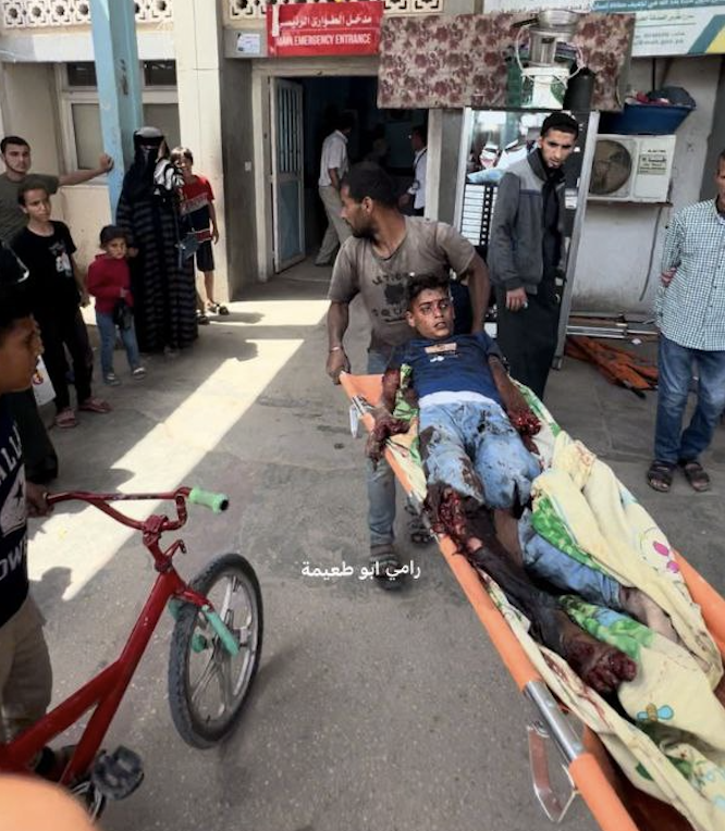 jacksonhinkle's tweet photo. 🇮🇱 ISRAEL BOMBED his house.
🇮🇱 ISRAEL left behind canned goods lined with explosives.
🇮🇱 ISRAEL robbed him of his hands and legs. https://t.co/6jDDg0wV7W