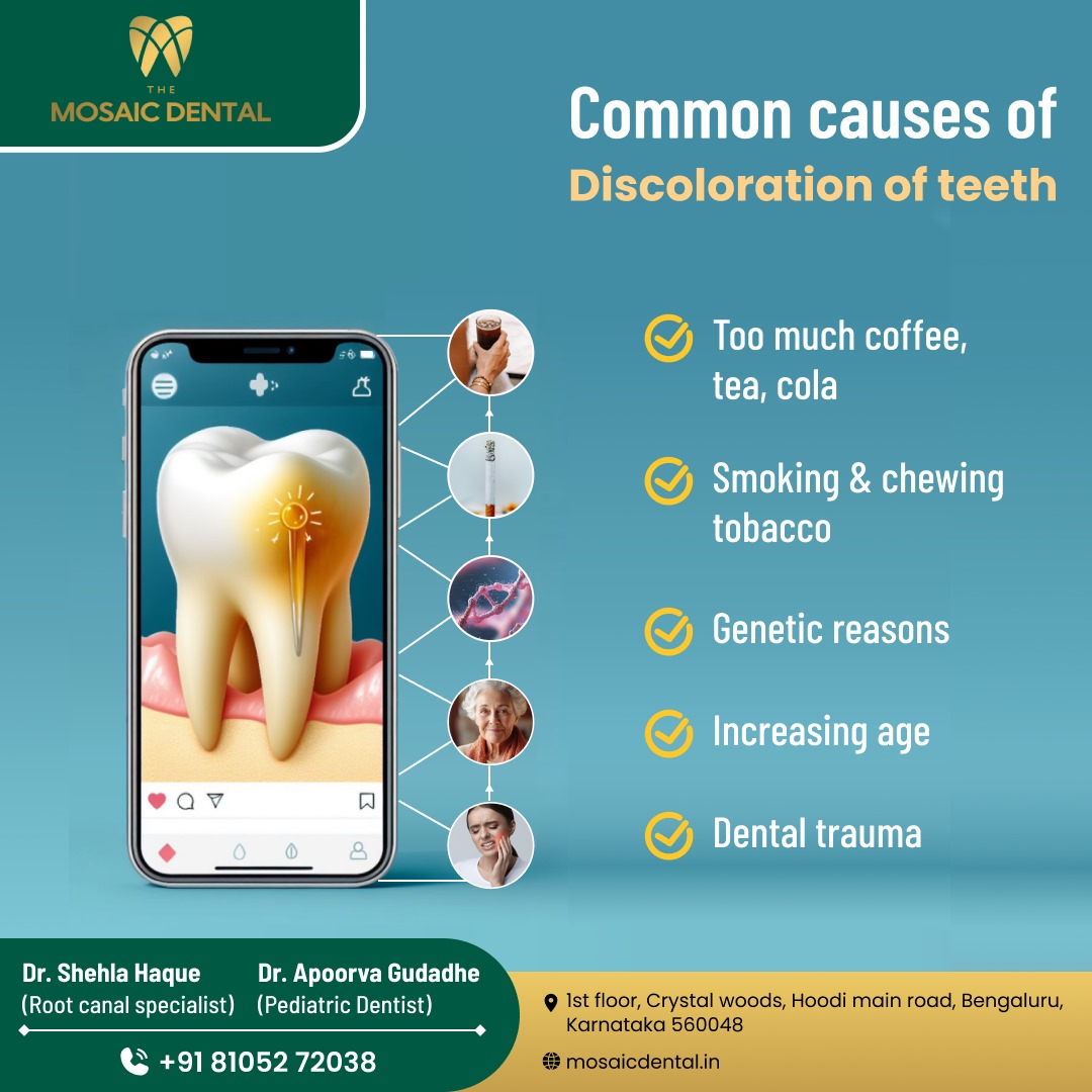 TheMosaicDental's tweet photo. Ever wondered why your pearly whites aren't so pearly? 🦷 Let's uncover the mystery of #ToothDiscoloration!
https://t.co/nRqBxuW0ET
#TheMosaicDental #MosaicDental #YellowTeethNoMore #GetYourSmileGlowing #CausesOfToothDiscoloration #InstaDentist #Bangalore #Karnataka https://t.co/2iNlMbCUiv