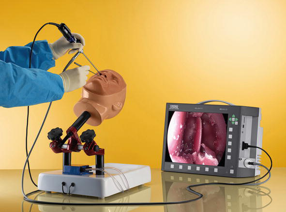 #Neuroendoscopy: A game-changer in #neurosurgery! This MIS technique precisely treats brain, spine, and nerve conditions. Less pain, quicker recovery. It's not just surgery; it's innovation at work! #MedicalAdvances #BrainHealth Is it enough?