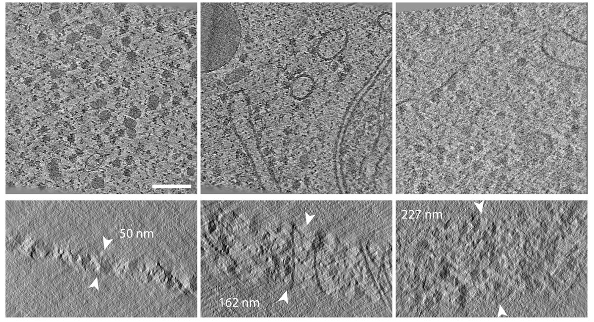 Max Planck Institute of Biophysics (@mpibp) on Twitter photo How to optimize samples to study subcellular architecture and structures of biomolecules in situ by #cryoET?
đź’ˇNovel insights on optimal lamellae thickness and extend of structural damage in cryo-FIB milling by M. W. Tuijtel & coworkers published in <a href="/ScienceAdvances/">Science Advances</a>! #biophysics How to optimize samples to study subcellular architecture and structures of biomolecules in situ by #cryoET?
đź’ˇNovel insights on optimal lamellae thickness and extend of structural damage in cryo-FIB milling by M. W. Tuijtel & coworkers published in <a href="/ScienceAdvances/">Science Advances</a>! #biophysics