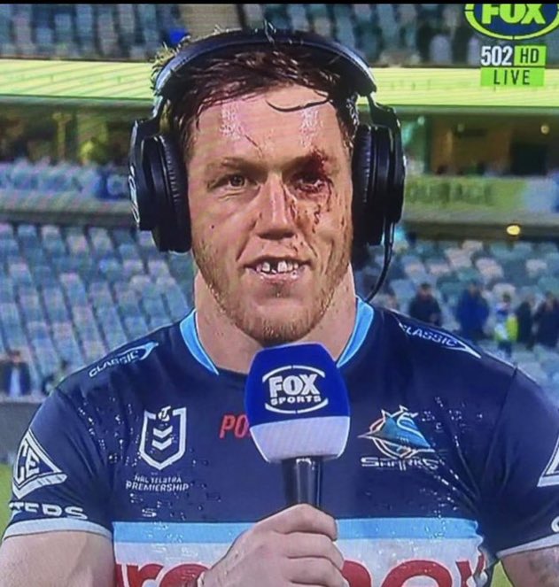 “I’m too sexy for my teef” 🦷 🦈 🩸 🏉 

#NRLRaidersSharks
#NRL
#CronullaSharks
#UpUpCronulla