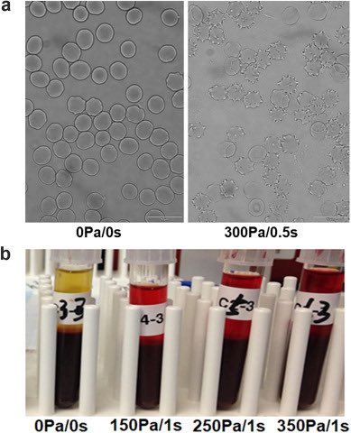 medntdj's tweet image. Non-physiological shear stress-induced blood damage in ventricular assist device
sciencedirect.com/science/articl…
#Ventricular assist device #Non-physiological shear stress #Blood damage #Thrombosis #Bleeding
@medntdj via @SciencNews
#MEDNTD #MedicalDevice #Science #MedEd #MedX