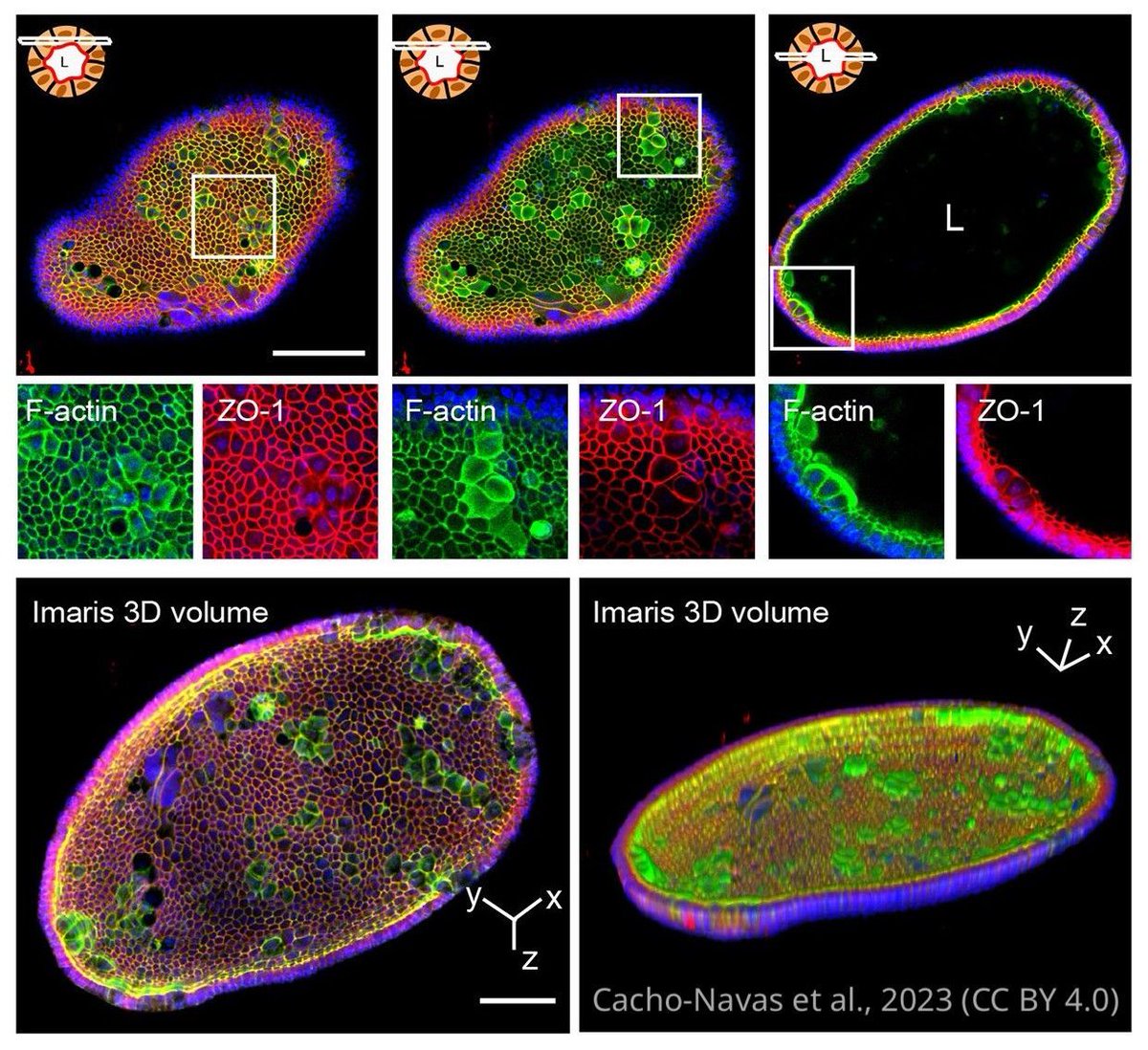 The novel function of apical ICAM-1 in regulating bile duct homeostasis in the liver. elifesciences.org/articles/89261…