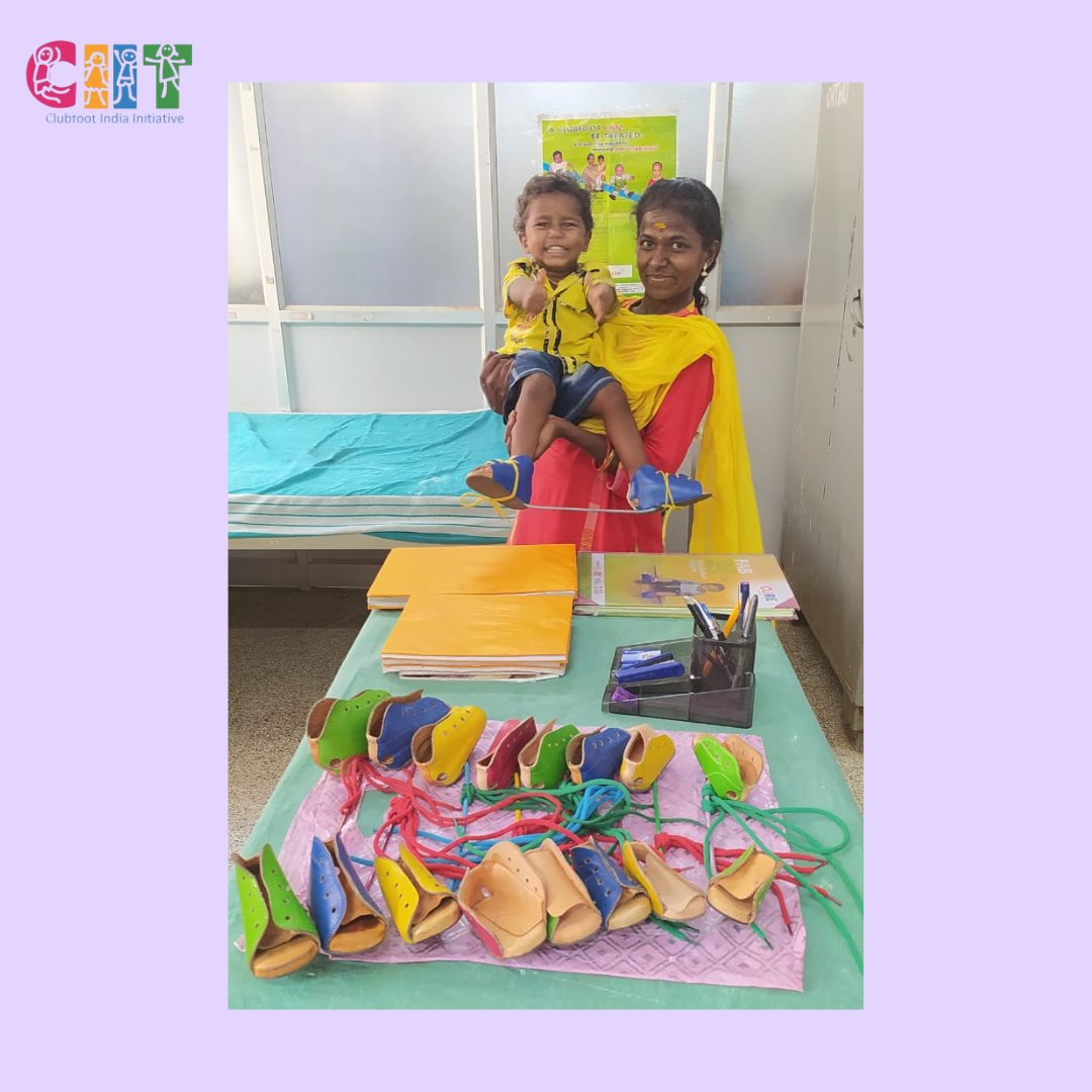 What does the future hold for children with Clubfoot?

Babies who undergo treatment with the casting and foot abduction brace method can expect to have feet that appear normal, with excellent mobility & functionality throughout their lives. 
#clubfoot #clubfootawareness #ponseti