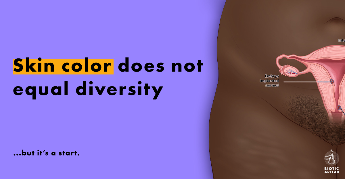 Skin color ≠ diversity, but it's a start. How do we digest something as abstract as diversity in #medicalillustration? A look at skin color can give us a glimpse into the gaps in our healthcare system. Read more: rb.gy/9m4d4y #IllustrateChange #jnj #Diversity