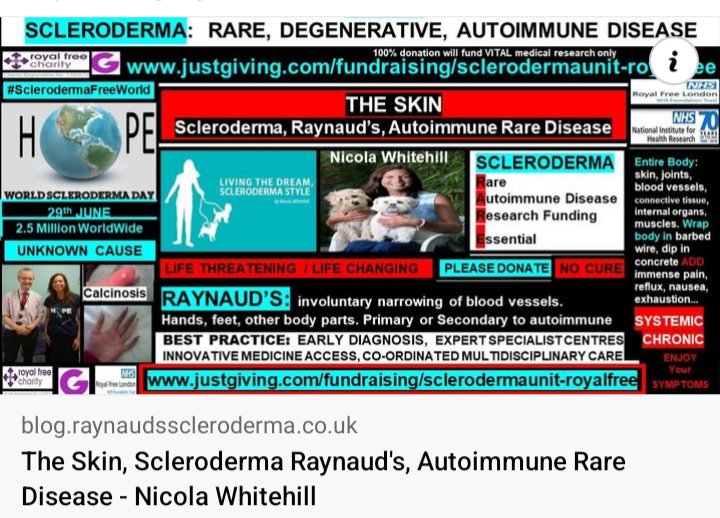 The Skin in Systemic Sclerosis: 
blog.raynaudsscleroderma.co.uk/2017/04/skin-i… 
#SclerodermaFreeWorld #RaynaudsFreeWorld 
#Research #Scleroderma #SystemicSclerosis #Raynauds #Autoimmune #RareDisease #NoCure #UnknownCause #LifeChanging #ConnectiveTissue #DreamSnatcher #Disability #ThickSkin