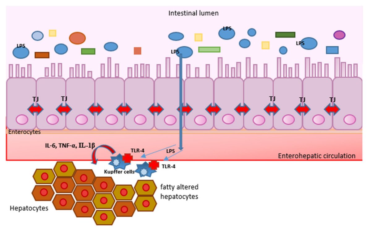 🌟#notablepaper on the Topic of inflammation 📚Alcohol, Inflammation, and Microbiota in Alcoholic Liver Disease 🔗mdpi.com/2133780 👨‍🔬By Dr. Marija Branković et al @MDPIOpenAccess @MDPIBiologySubj #inflammation #alcohol #microbiota #alcoholichepatitis