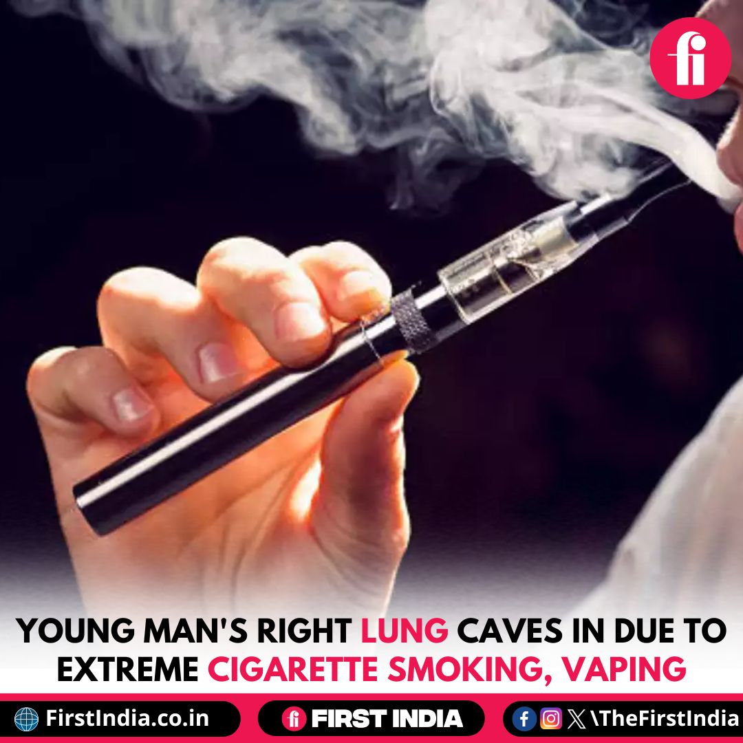 Young fisherman's vaping addiction leads to collapsed lung mistaken for heart attack. Jordan Snowdon, 29, rushed to hospital after experiencing throbbing pains and breathlessness. Shocking revelation prompts caution on vaping risks. 

#Shocking #Health #World #Cigarette #vape