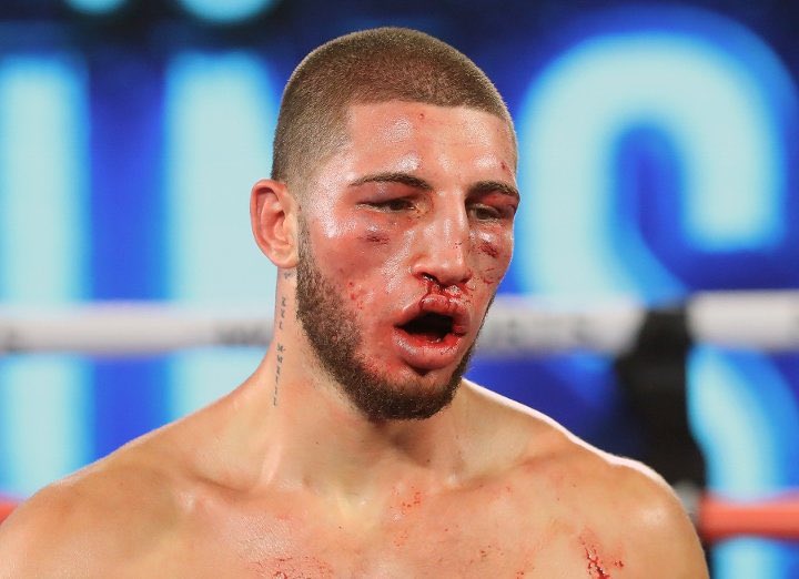 StopArabHate's tweet image. 🚨 UPDATE: The man who spat on someone and called him the “n word” at @UCLA has been identified as David Kaminsky

He is a boxer and owns Kaminsky Boxing Gym in Los Angeles