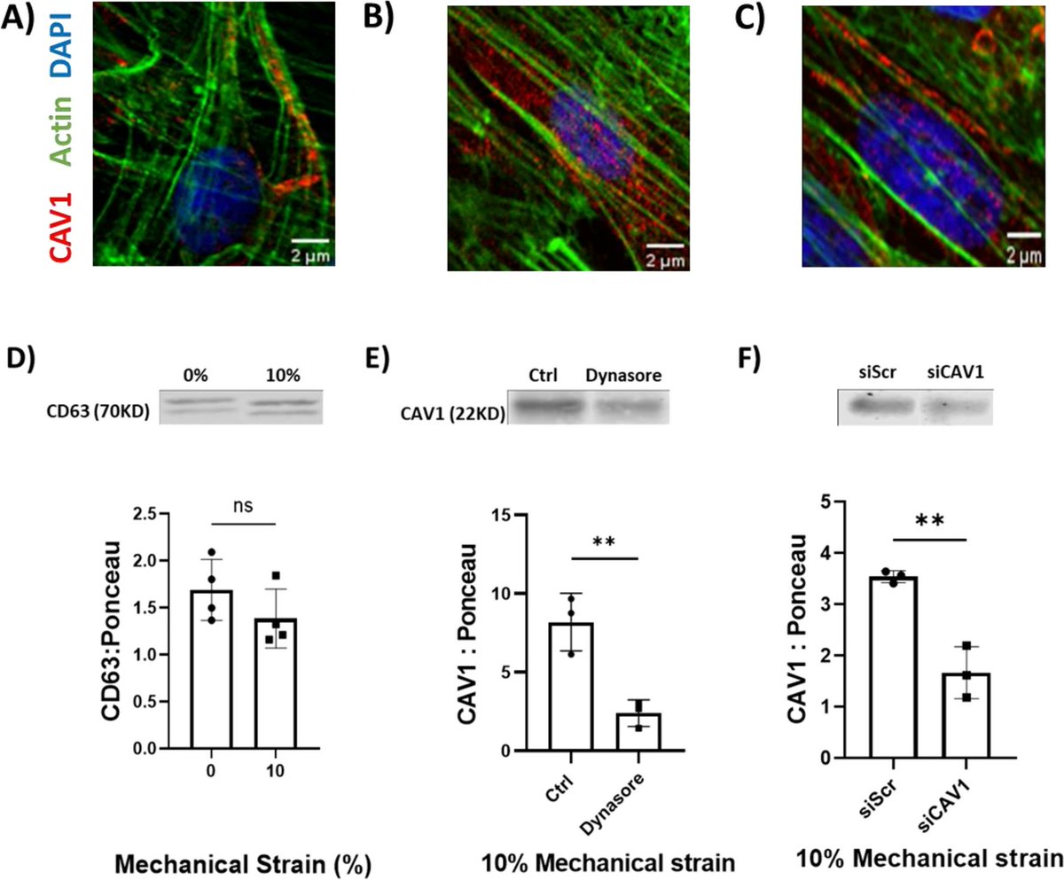 New research in #BMCMolCellBiol reveals how hypertension-induced stress affects vascular cells, leading to changes in Cav-1 trafficking, extracellular vesicles release and increased risk of vascular calcification. bit.ly/3UmwqWM