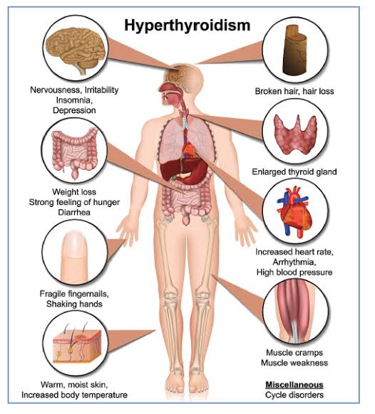 5- Hyperthyroidism- Extreme workplace stress leads to elevated thyroid hormone levels. And not just this, it is a leading cause of obesity and belly fat as well.

So now you know how negative thoughts can impact your body and health...