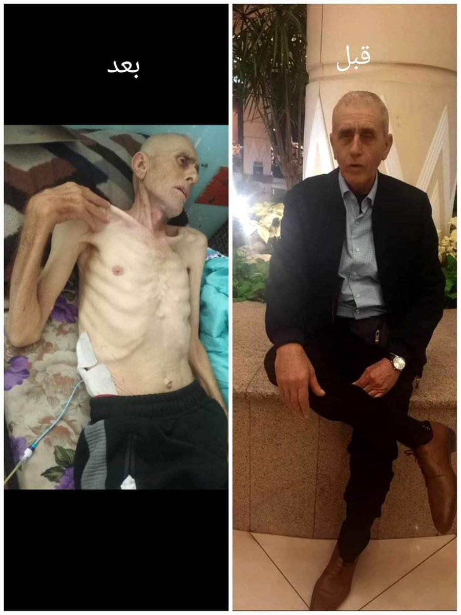 Urgent plea for medical assistance for my family: My beloved uncle Mahmoud Shabat, who has been like a father to me, is slowly slipping away in front of our eyes. Once a vibrant and lively soul, he has been battling a deteriorating health condition for months now. The harsh