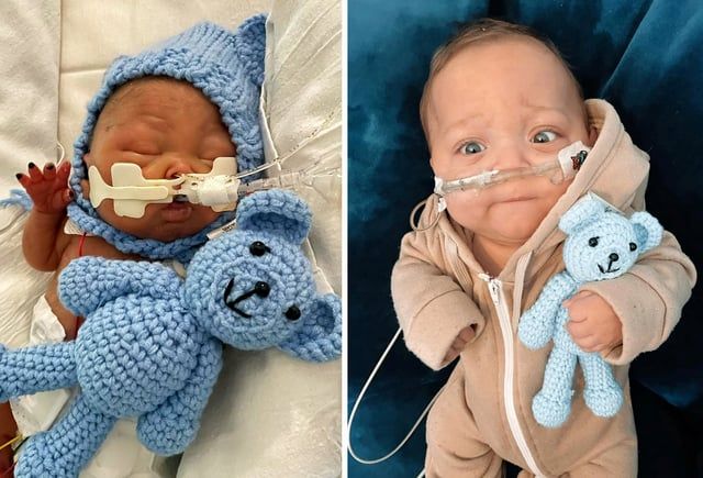 Premature Baby Born at 23 Weeks Survives After Parents Refuse to Turn Off His Life Support buff.ly/3MGndmI