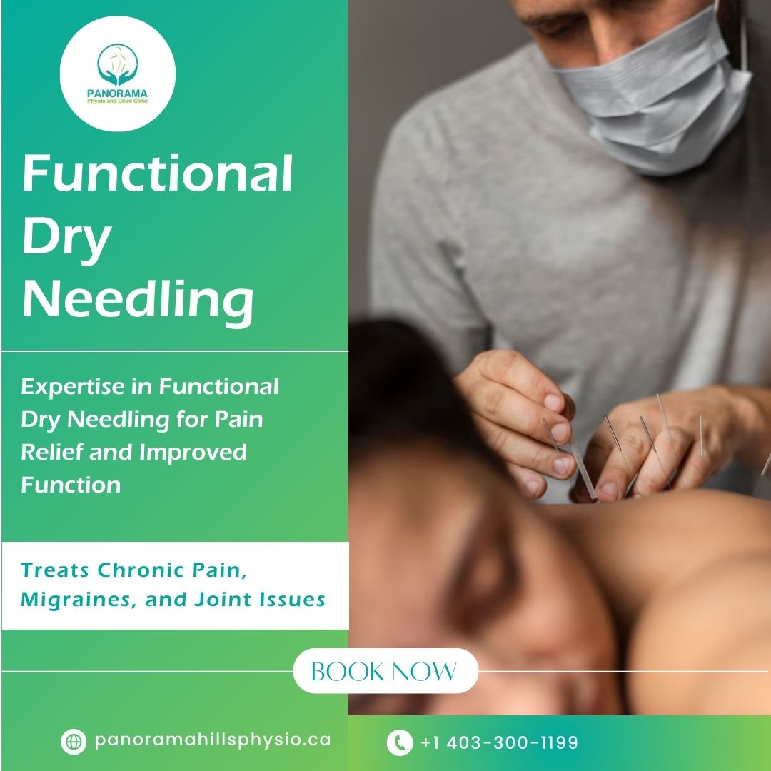 'Unlock pain relief and enhanced function with our expertise in Functional Dry Needling. Experience the difference today!'

panoramahillsphysio.ca/services/funct…

#panoramahillsphysio #manualTherapy #manualtherapy #Recovery #Healthcare #experts #HealingHands #MassageClinic #FeelBetter