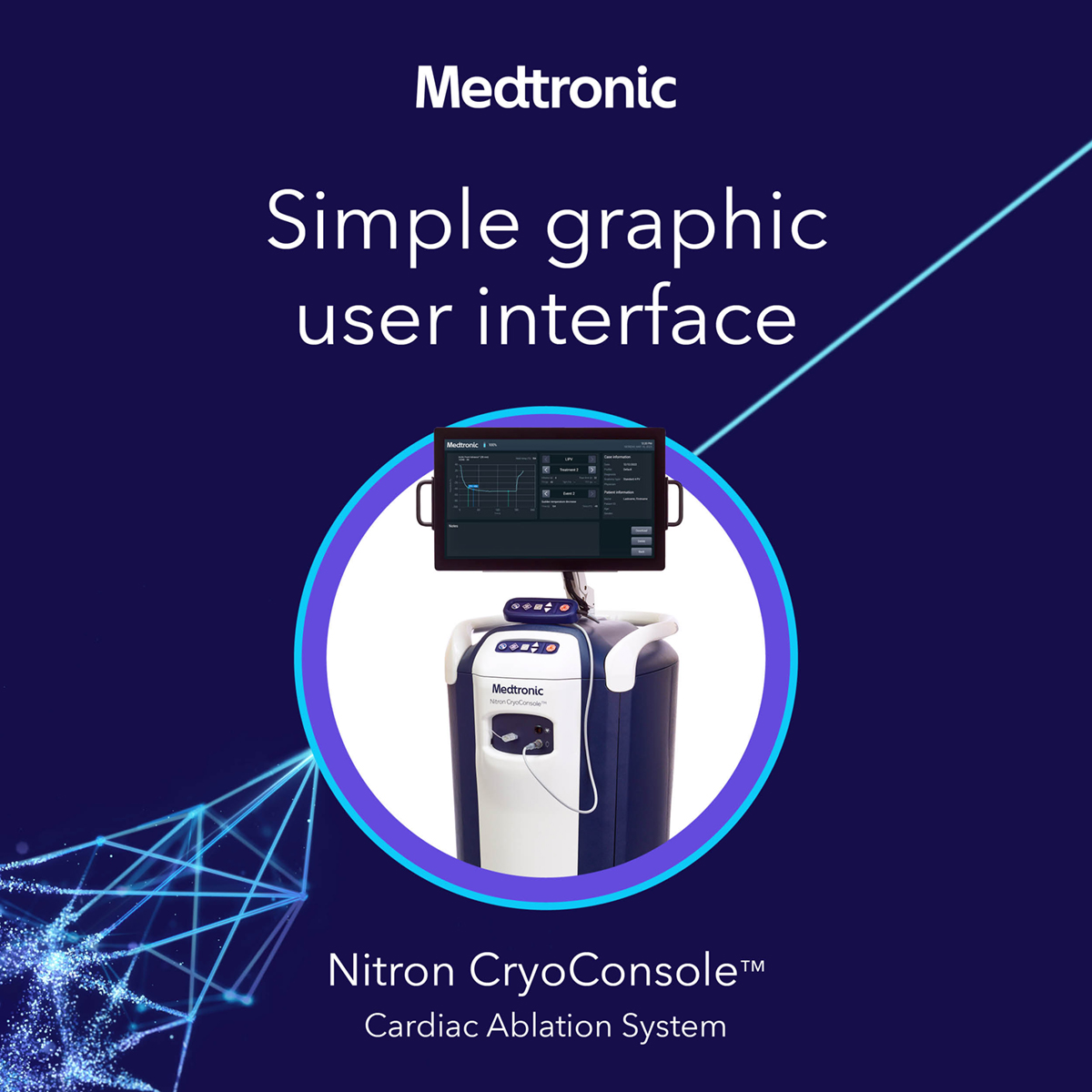 The Nitron CryoConsole™ system offers a simple GUI with intuitive system operation guidance, custom user profiles, and visual indicators of procedure parameters like TTI, previous freeze trace. Learn more: bit.ly/4bgYr8Q See risk/benefit info: bit.ly/4bdy2Jd