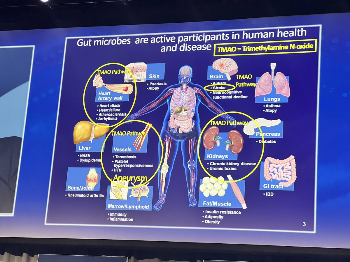 “Each of the circled pathways are linked to the development of #cardiovascular disease.” - Stan Hazen, @ClevelandClinic #AATS2024