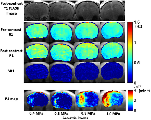 🧠 Read 'Feasibility of measuring blood-brain barrier permeability using ultra-short echo time radial magnetic resonance imaging,' recent work from J. Bae, S. Qayyum, J. Zhang, A. Das, E. Aronowitz, & G. Kim, in @JNeuroimaging via @asneuroimaging, here 👉 tinyurl.com/yc76s7wx