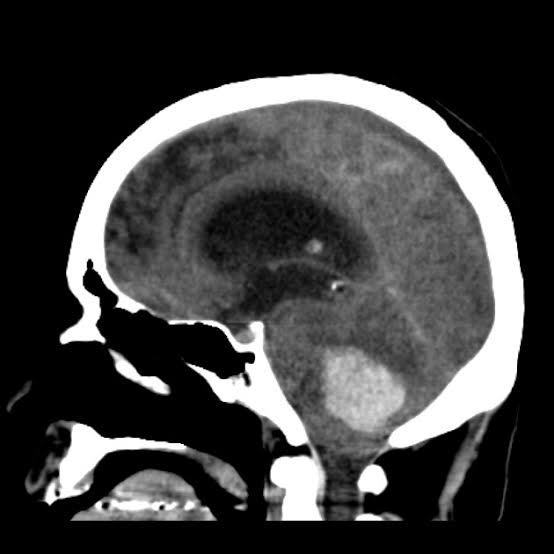 What's your diagnosis!!! #MedX #MedEd