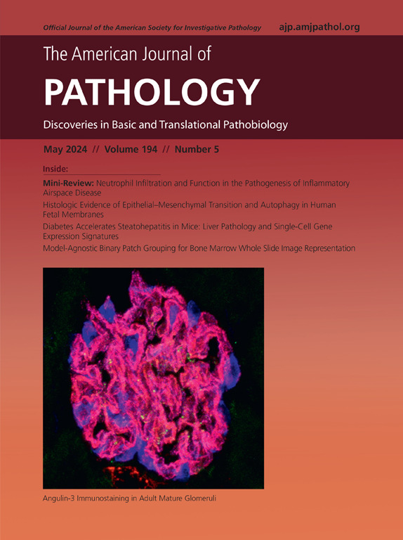 The May issue of @AJPathology is now live! Full issue: ajp.amjpathol.org/issue/S0002-94… On the cover: Angulin-3 immunostaining in adult mature glomeruli.