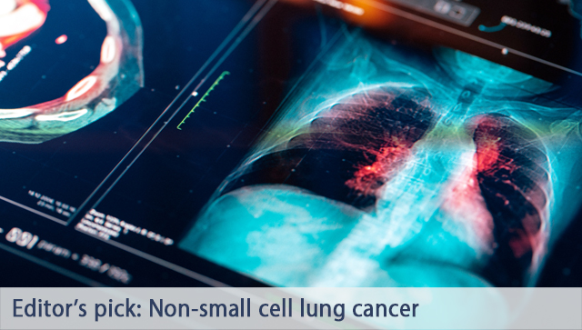 This week's editor's pick: Non-small cell lung carcinoma Generally, patients treated with targeted therapy have better symptom control, response rates, and overall survival than those treated with conventional chemotherapy. Lean more ➡️ cmaj.ca/lookup/doi/10.… (earn CPD credits)