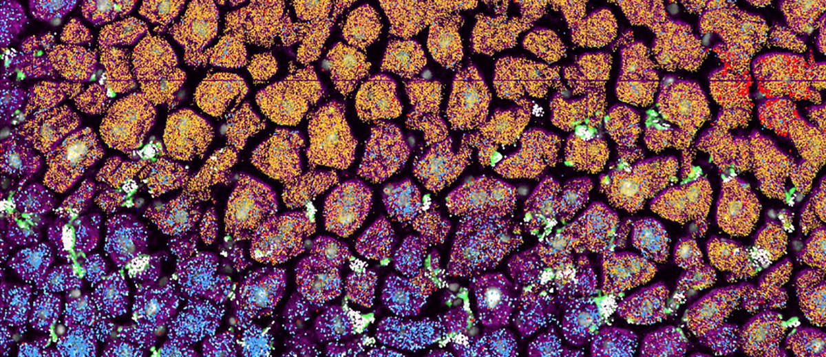 🗺️ Location, location, location. No, we're not talking about real estate, but about the importance of cellular position in tissues and organs. Spatial omics is here to build 3D maps of cell activity! Read all about it here 👉 vibbio.tech/44mar71