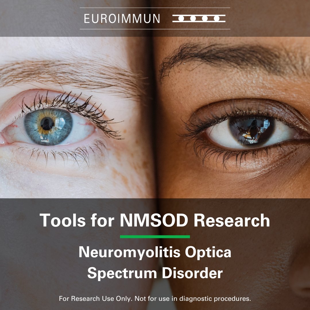 Discover our advanced immunofluorescence solutions for researching autoantibodies in Neuromyelitis optica spectrum disorder (NMOSD). Our patented BIOCHIP technology saves time and conserves samples.
🔬 Discover More: ms.spr.ly/6011YyJBc