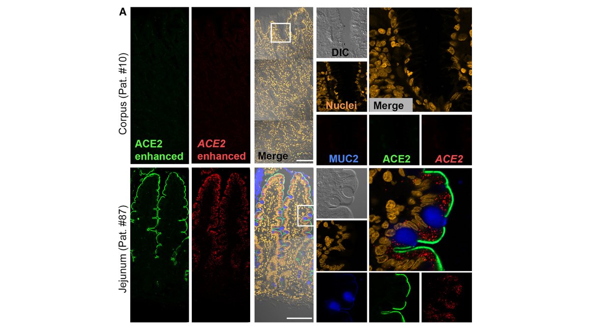 New Research: SARS-CoV-2 tropism to intestinal but not gastric epithelial cells is defined by limited ACE2 expression

@Uni_WUE @SinaBartfeld @ChariteBerlin @TUBerlin | @ISSCR @CellPressNews @MartinPeraJAX 

ow.ly/yQnF50Rp44U