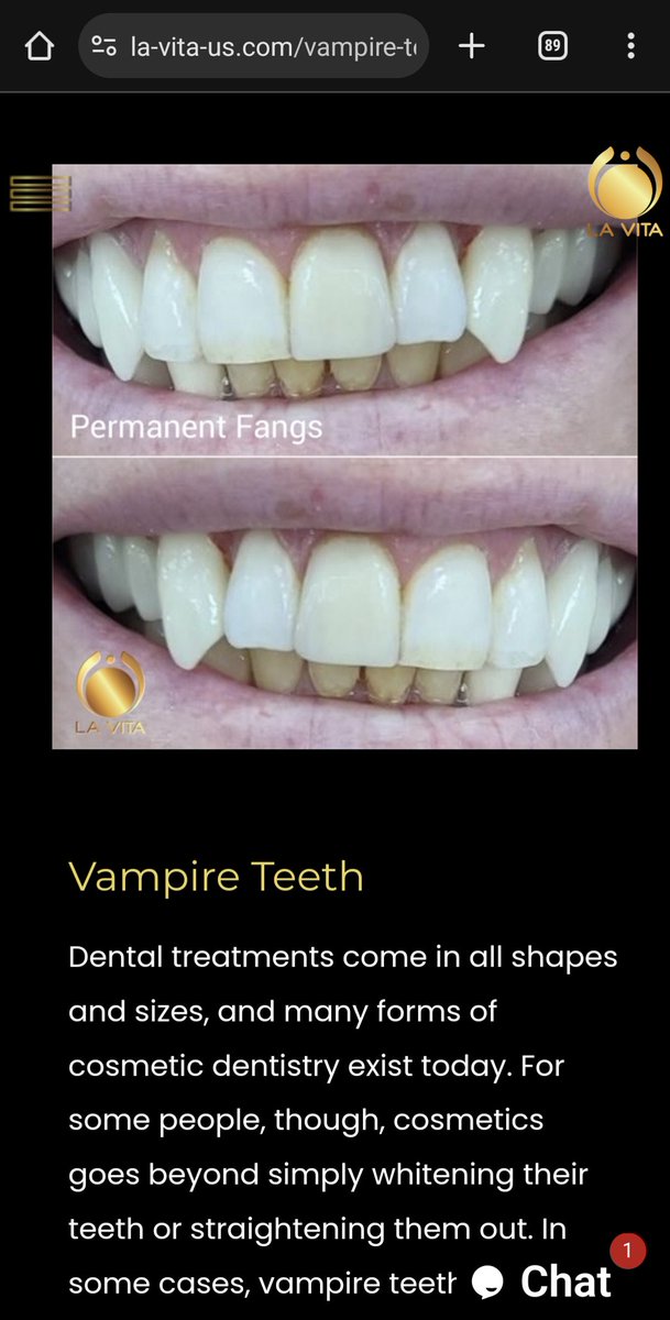 Getting permanent fangs should qualify as gender affirming care and be covered by insurance. Thanks for coming to my Ted Talk.
