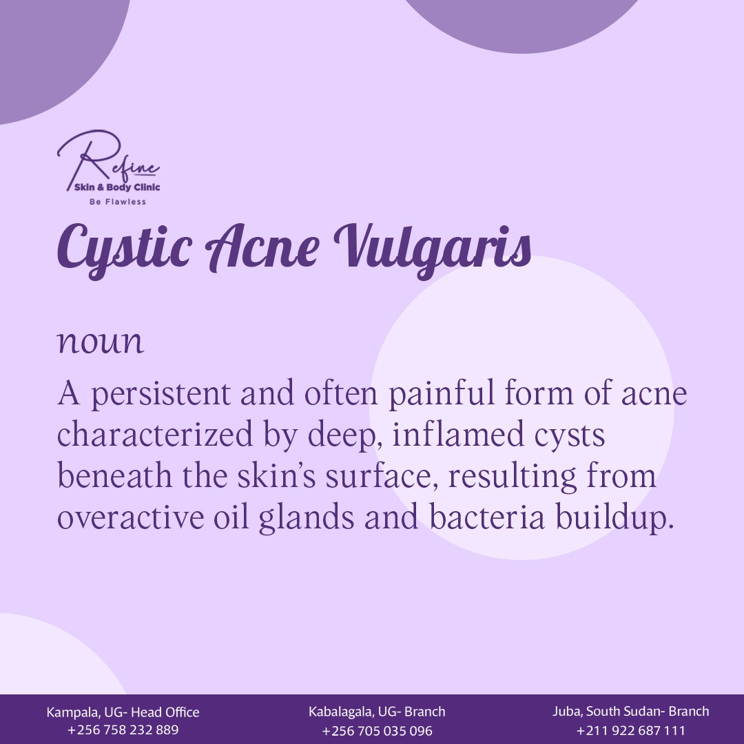 To treat Cystic Acne Vulgaris, it's not just about blemishes; it's about understanding the complex interplay of oil production, bacteria & inflammation. At #RefineSkinandBodyClinic, we dig deeper and conquer this challenge to achieve more precise, healthier skin.
#acnetreatment