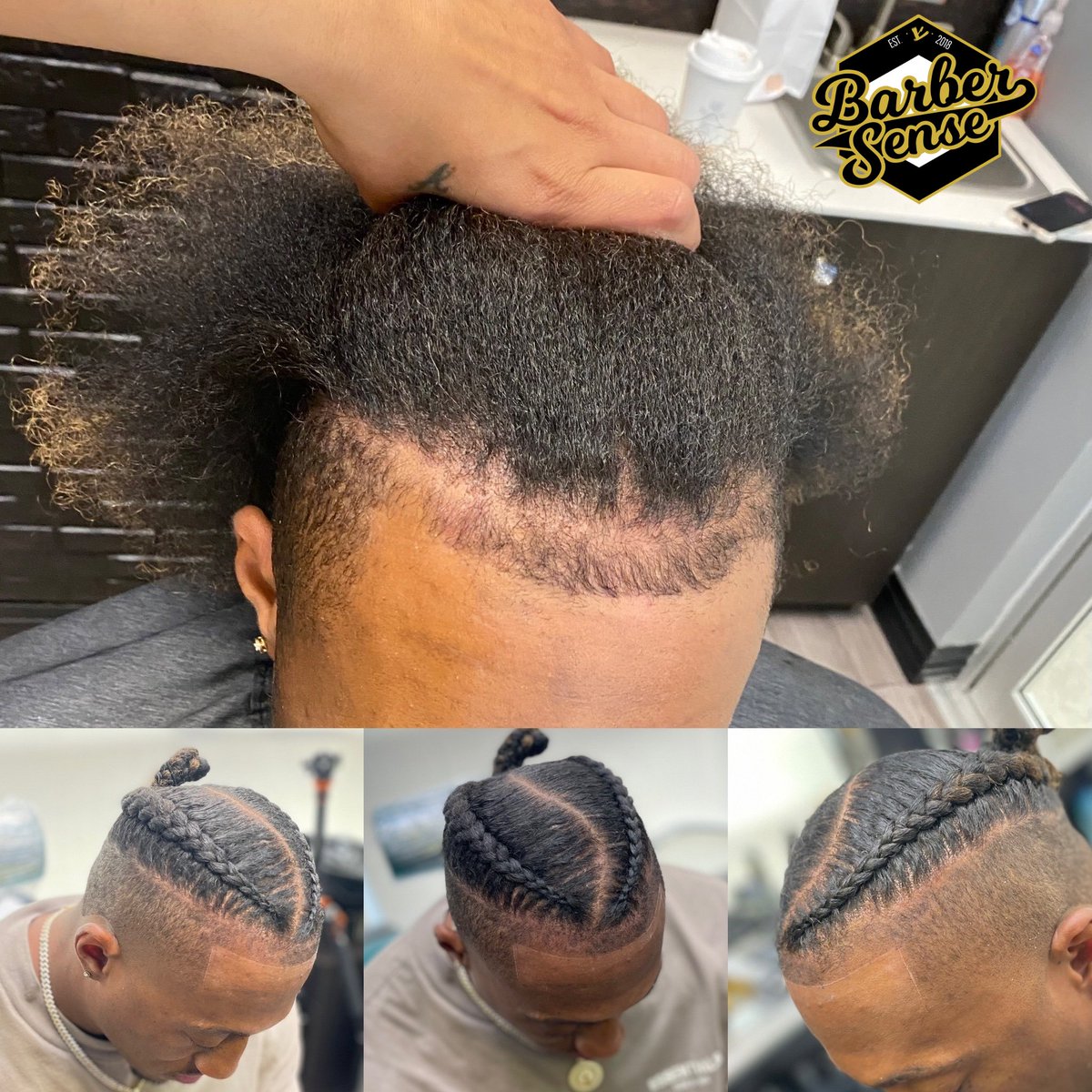 😱This is only 1 session! Stay tuned for the next one. #InstantResults #SMP #ScalpMicropigmentation #Alopecia #BaldMen #AtlantaSMP #FreeConsultations