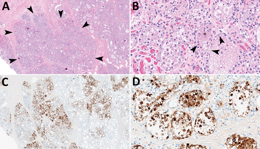 Just out in Emerging Infectious Diseases: Highly pathogenic avian influenza H5N1 virus infects epithelial cells of mammary alveoli (where milk is produced) of the udder in dairy cows. #vogelgriep 1/2
wwwnc.cdc.gov/eid/article/30…