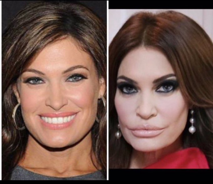 I don't know about you, but i prefer the version on the left before she met Trump Jr. Which do you prefer?🤣