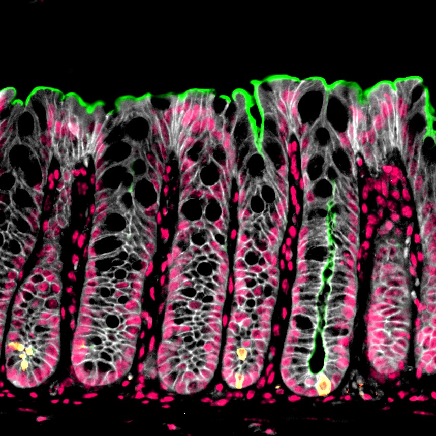 Happy #MicroscopyMonday! Immunofluorescence staining of the colon highlighting the brush border (green), cell membrane (white), tuft cells (yellow), and nuclei (pink).

#microscopy #sciart #pathart #bioart #histoart #intestine