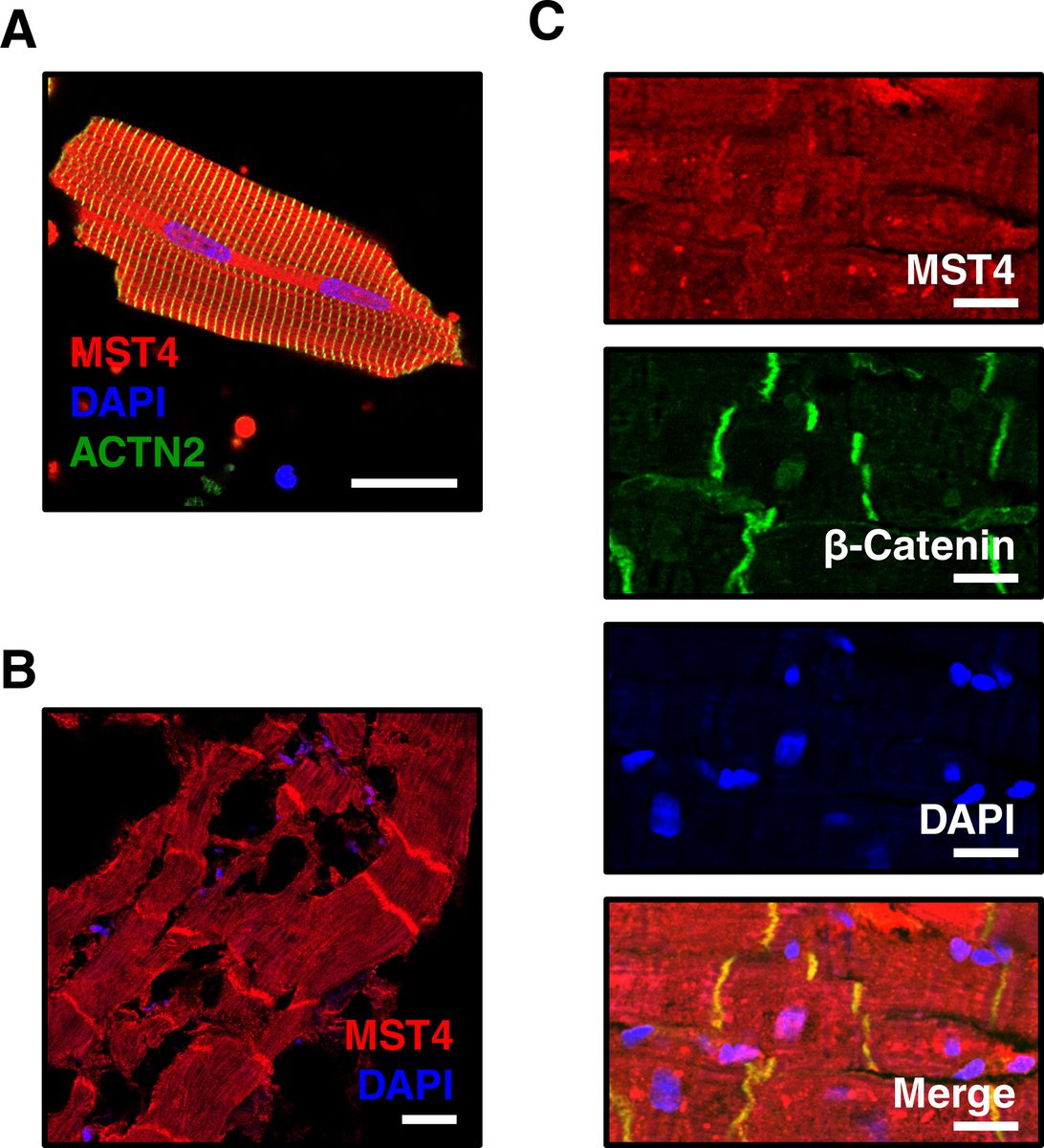 New in JBC press: 'Researchers identified Mst4 as a novel cardiac kinase that is upregulated in human cardiomyopathy and regulates cardiomyocyte growth and survival.' Learn more: jbc.org/article/S0021-…