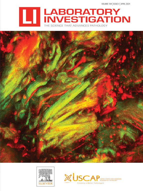 Our BEAUTIFUL April Cover! STUNNING! 'Computer-Aided Multiphoton Microscopy Diagnosis of 5 Different Primary Architecture Subtypes of Meningiomas' laboratoryinvestigation.org/article/S0023-…