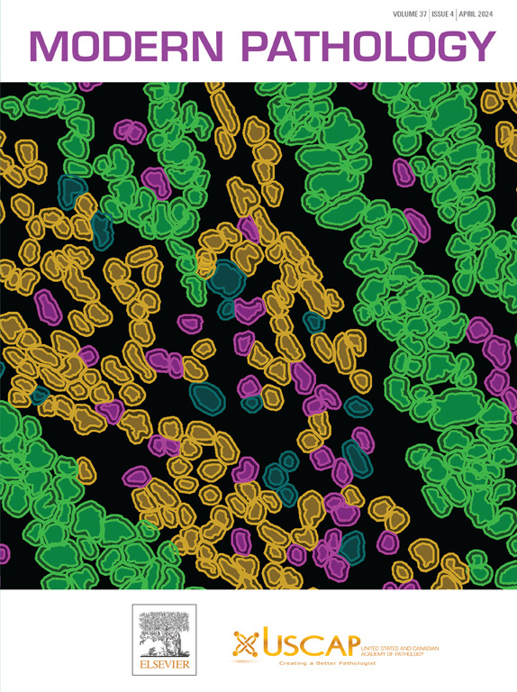 Our APRIL cover is ABSOLUTELY STUNNING! 'Machine learning–based image analysis for detecting and classifying tissue compartments and cells in QuPath. Tissue compartments were classified.......' modernpathology.org/article/S0893-…