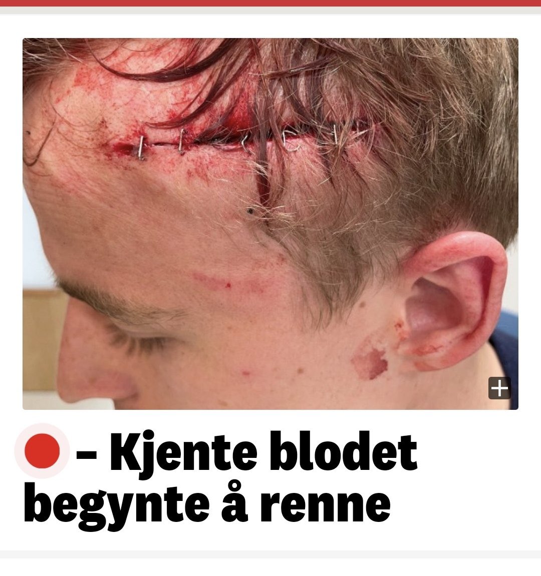 Latterlig å se folk mene dette ikke skal være rødt kort!!!